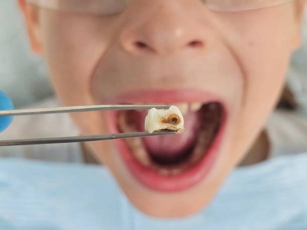 Best Emergency Denture Repair in Elwood, NY